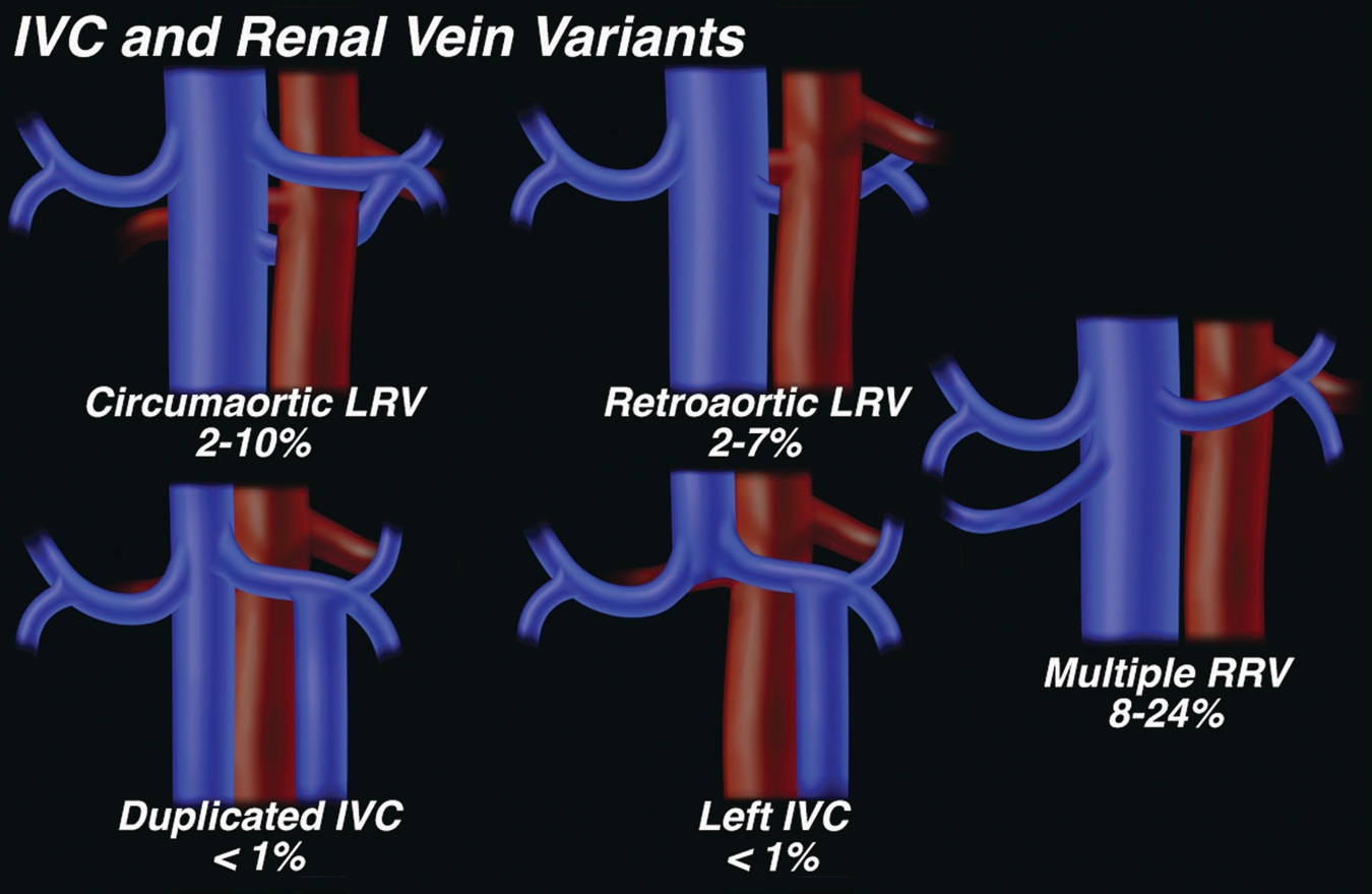 Renal vascular anatomy